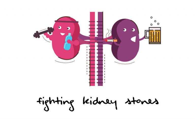 Fighting Kidney Stones