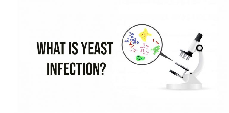 Yeast Infection : Description, Causes and Treatment