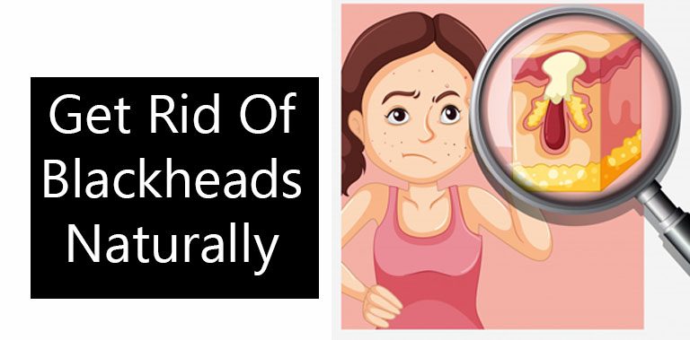 How To Get Rid Of Blackheads Completely Naturally