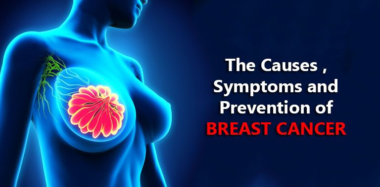 Breast Cancer Symptoms, Causes and Prevention