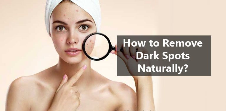 How to Remove Dark Spots Naturally?