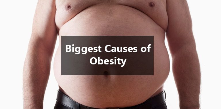 Causes Of Obesity