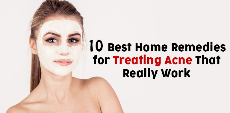 10 Best Home Remedies for Treating Acne That Really Work