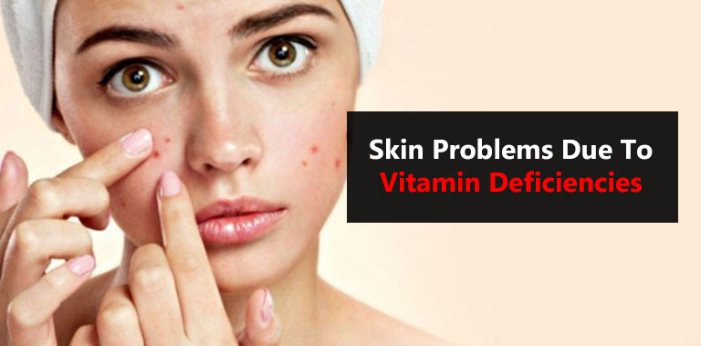 Skin Problems Due To Vitamin Deficiencies | Doctor ASKY