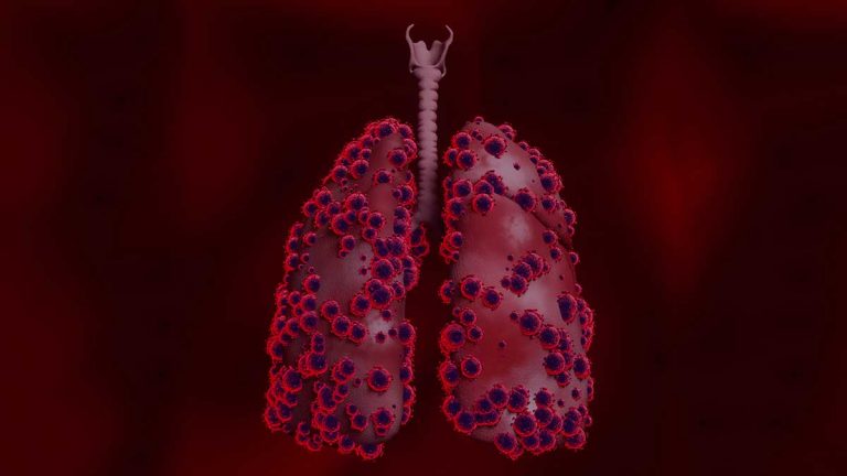 Underlying diseases that increases the risk of complications in Coronavirus Infection