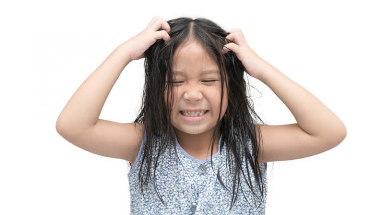 How To Get Rid Of Lice?