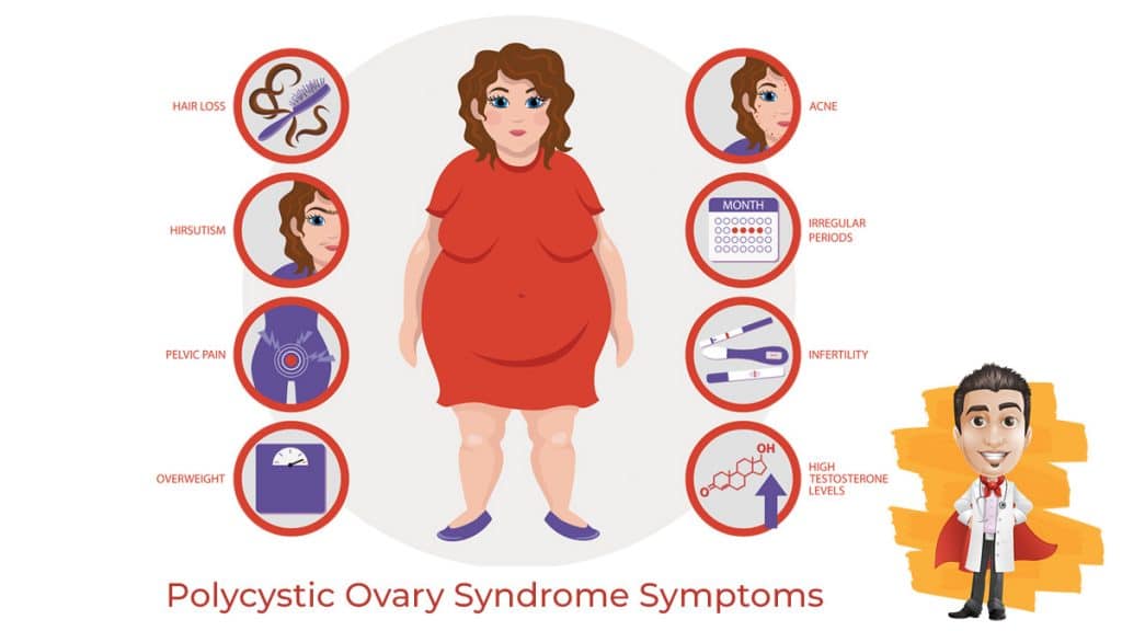 Polycystic ovary syndrome 