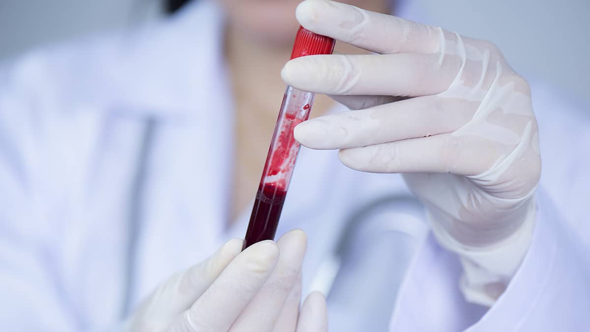 Why Should You Know Your <b>Blood</b> Type? 