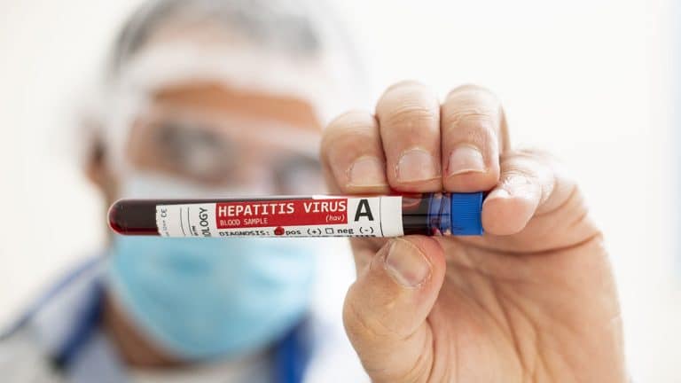 Hepatitis-A