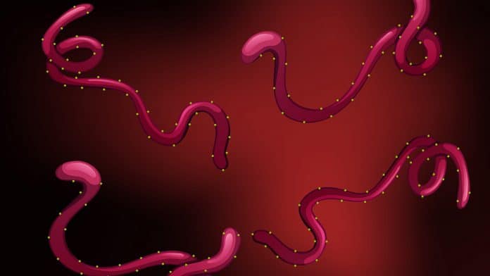 Ebola Virus Disease