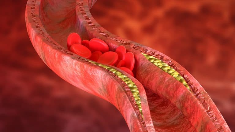 Foods to Eat for Healthy and Clean Arteries!