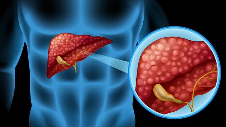 Hepatitis B Result In Liver Cancer