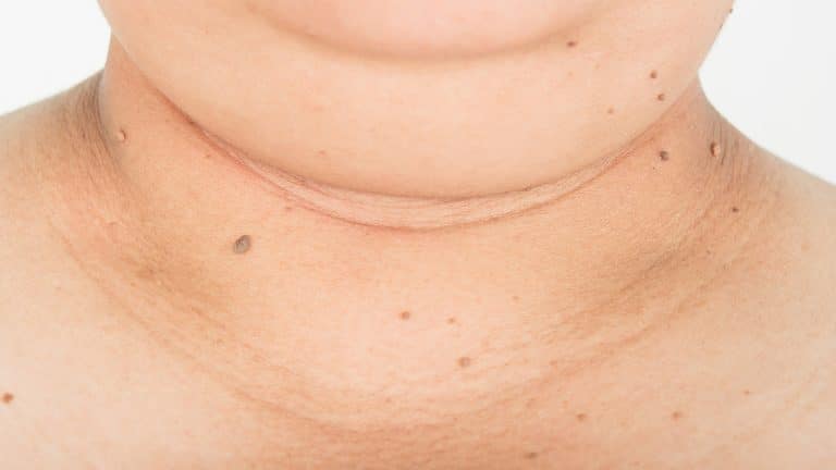 How To Reduce Double Chin