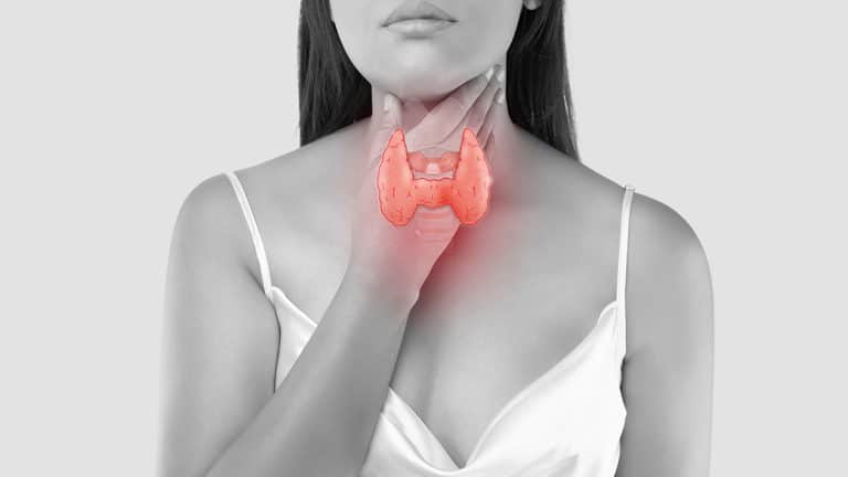 Hypothyroidism