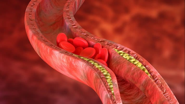 Keep-Your-Arteries-Healthy