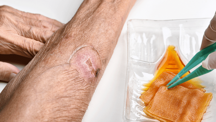 Why It Takes Longer For Diabetic Wounds To Heal