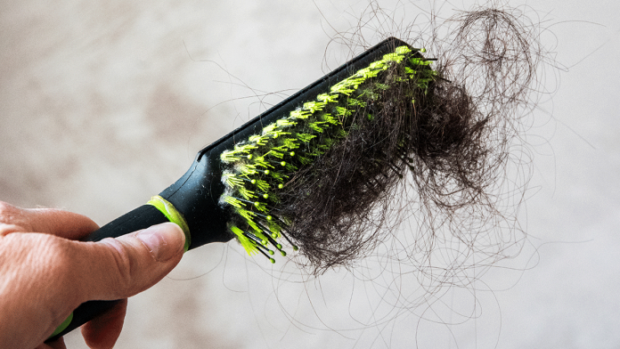 Causes-and-Treatments-of-Hair-loss